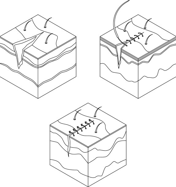 手术缝合图标设置轮廓图片下载