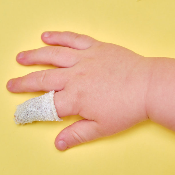 婴儿的手与包扎的手指在黄色工作室背景，特写。孩子受伤的食指用白色绷带包扎图片下载