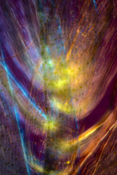 泥炭苔藓叶片的显微照片，带有偏振。图片下载