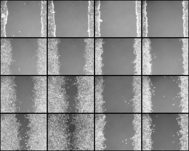 体外伤口愈合图片下载