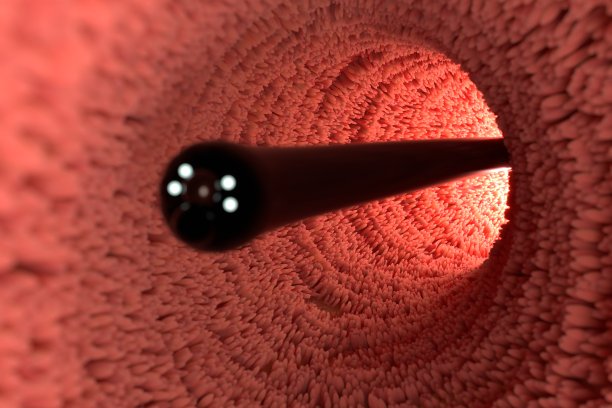 肠镜检查图像图片下载