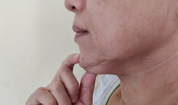 颈部的脂肪松弛和皱纹皮肤，下巴的赘肉和脂肪团。图片下载