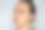 女性整容后面部恢复，眼睑成形术后，可见眼部伤口割伤，眼袋肿胀，皮肤缝合线肿胀，眼睑淤青。去除皮肤多余脂肪的整容手术图片下载