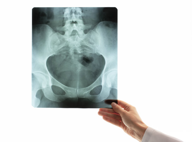 女医生手拿骨盆骨x光片。放射科医生根据光镜或底片的背景检查扫描图片下载