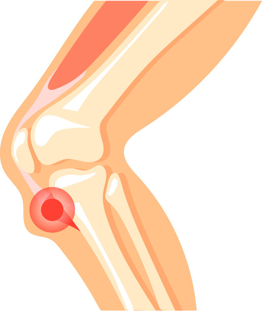 膝盖疼痛图标腿部解剖带红斑图片下载