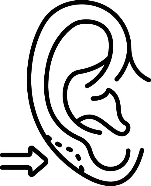 脂肪瘤切除概念，整形外科医生矢量线图标设计，美容和个人护理符号，美容皮肤病学标志，身体美学股票插图图片下载