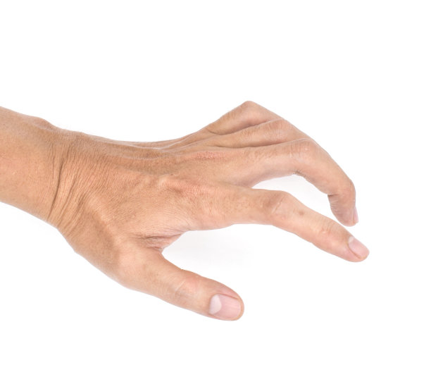 东南亚年轻男子沃克曼挛缩。图片下载