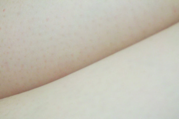 皮肤和皮肤轮廓图片下载