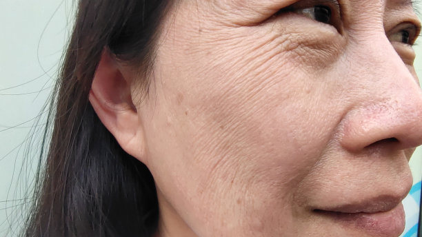 女性眼睑旁的松弛和皱纹，脸上的黑斑和粗糙的皮肤。图片下载
