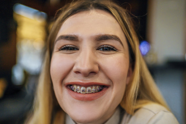 带牙套的健康微笑图片下载