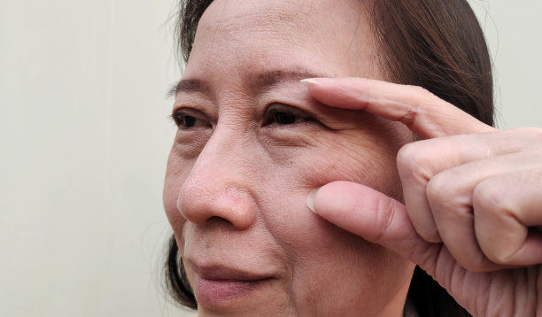 眼睑旁的松弛和皱纹，下垂和松弛的皮肤，脸上的黑斑和粗糙的皮肤。图片下载