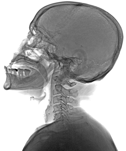 头颅和颈椎正常x线。侧面视图。图片下载