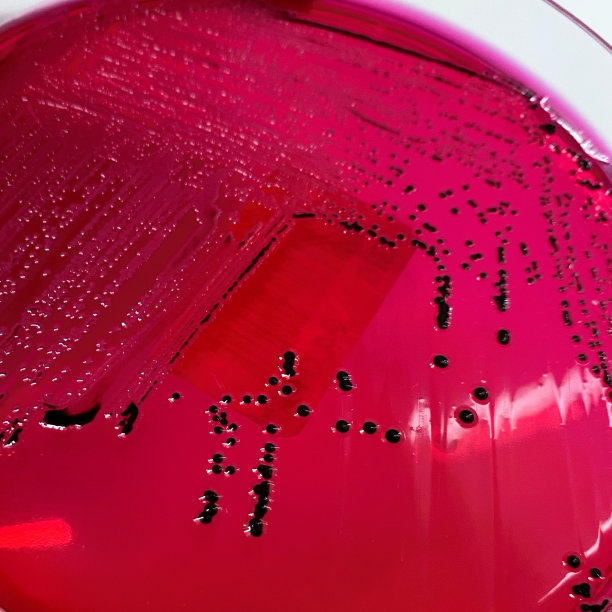 沙门氏菌在选择性琼脂板上生长。图片下载