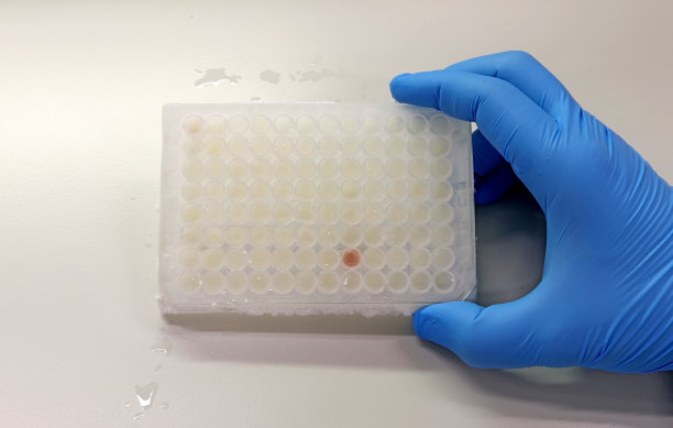 戴着蓝色手套的科学家之手采集冷冻临床样本图片下载