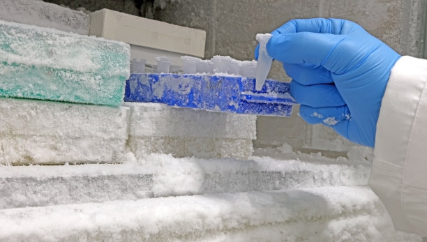 戴着蓝色手套的科学家之手采集冷冻临床样本图片下载