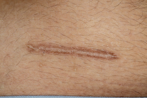 身体不同部位的伤疤。图片下载