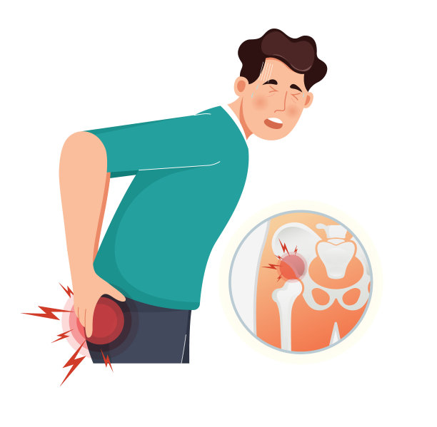 髋关节疼痛患者-库存插图图片下载