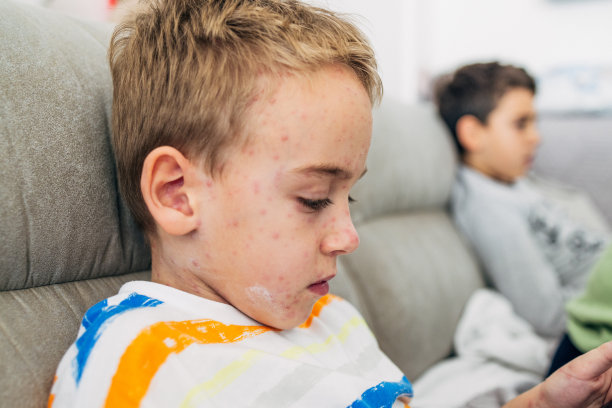 特写一个长水痘的男孩，坐在床上用手机图片下载