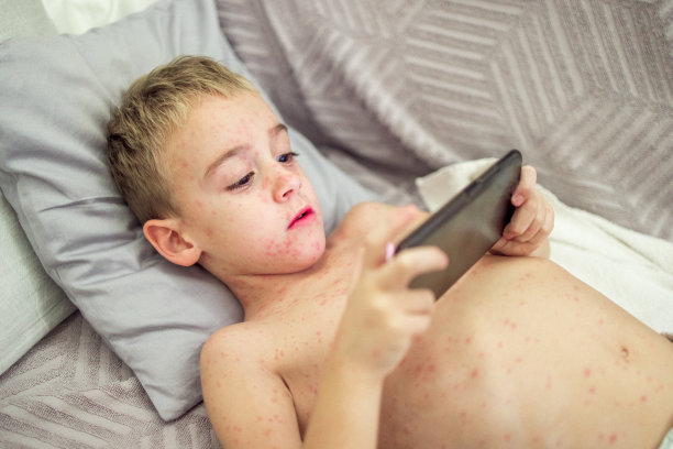 一个白人男孩躺在床上玩手机游戏，他的皮肤上长满了痘图片下载