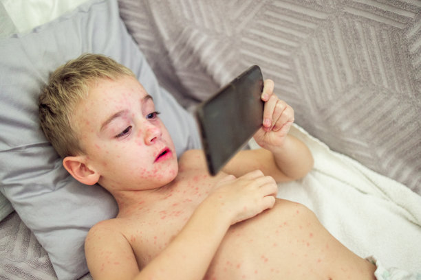 男孩一边用手机，一边皮肤发痒，长满了痘图片下载