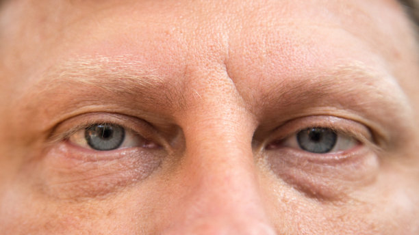 男性眼睛有浅色睫毛和眉毛，特写图片下载