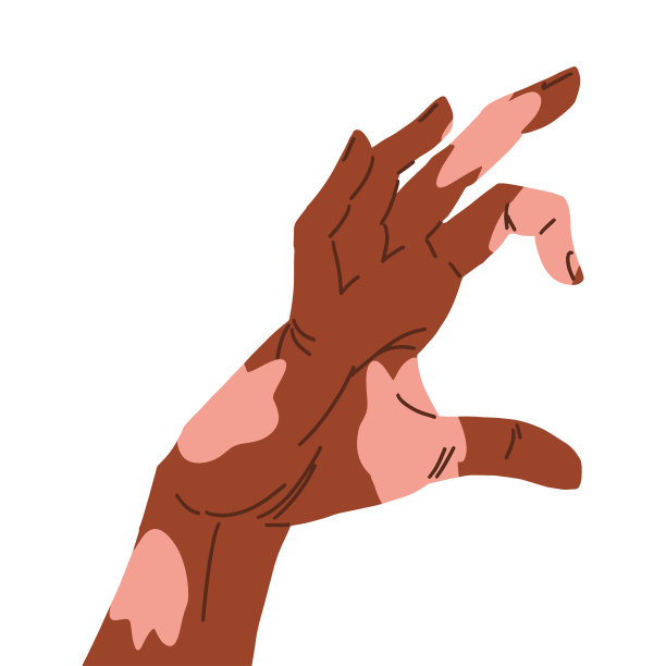 一只手做一半的心形，棕色皮肤上有白癜风补丁图片下载