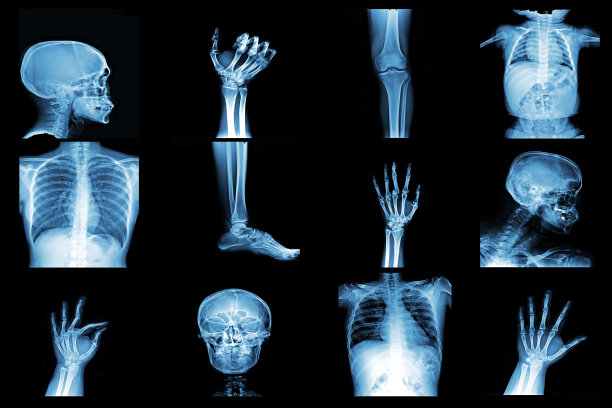 x射线拼贴病人身体的各个部分图片下载