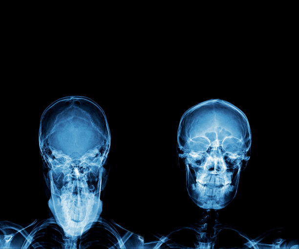 医用x光胶片图片下载