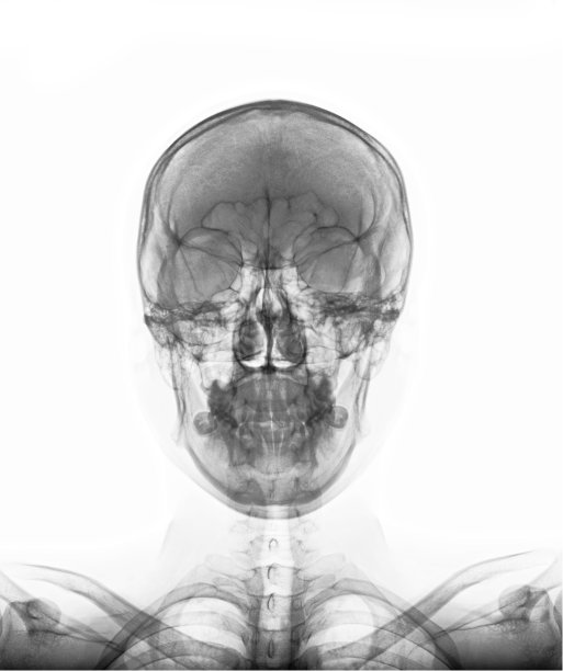 正常人类颅骨AP x光片。图片下载
