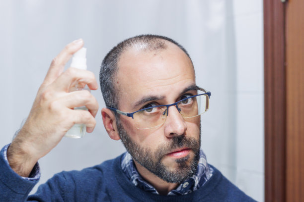 脱发的年轻人在镜子里看着自己的头和头发，并在家里使用喷雾药物图片下载