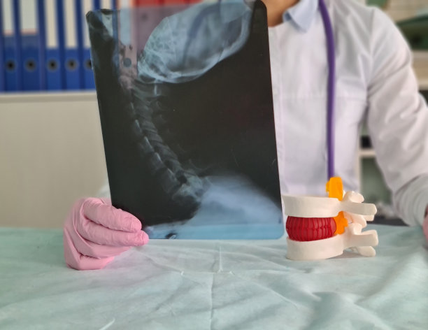 颈椎x线示终板后缘骨赘图片下载