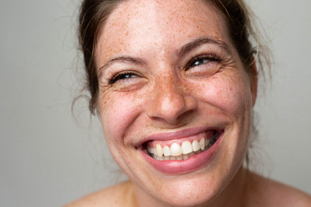 一个长着雀斑的漂亮女人图片下载