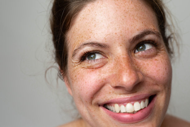 一个长着雀斑的漂亮女人图片下载