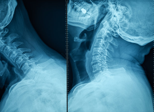 人体头颈x光片图片下载