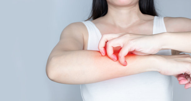 女性因皮肤病、癣、瘙痒或黄褐斑引起手臂瘙痒。图片下载