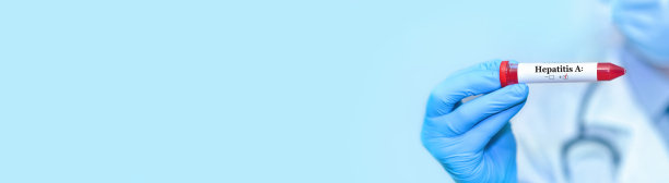 医生手里拿着一根甲型肝炎病毒(HAV)测试阳性的血液样管。横幅。本空间图片下载