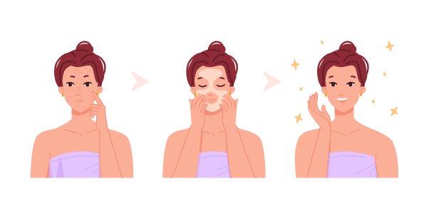 痘痘前后。少女痘痘治疗步骤，少女坏皮问题，美女护理脸涂抹化妆皂，女性化妆肖像少女护肤矢量插画图片下载