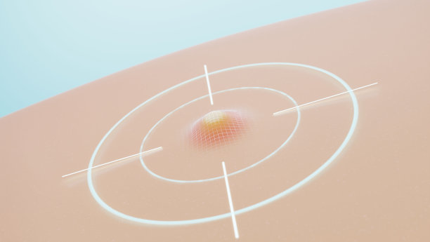 痤疮皮肤治疗图片下载