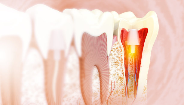 种植牙，颌骨和健康牙根，种植螺钉和基牙，牙医和正畸治疗，3d插图图片下载