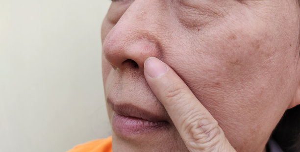 鼻子的整形，脸上的黑斑和瑕疵，嘴角的笑纹。图片下载