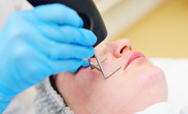 在一家现代美容诊所里，美容师使用二氧化碳分数烧蚀激光来恢复皮肤活力并去除疤痕。图片下载