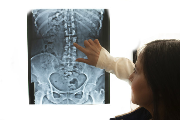 医生对一位先天性脊柱侧弯患者进行骨解剖分析和诊断图片下载