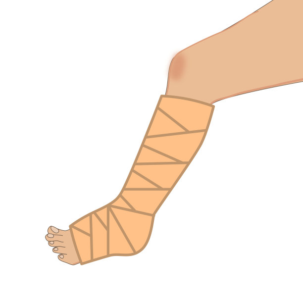 断腿在绷带图标，受伤的脚在绷带，骨科石膏，创伤骨，卡通风格的标志在白色背景。图片下载