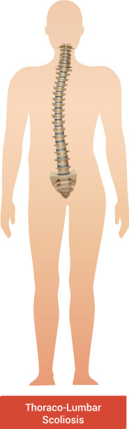 胸腰椎侧凸组成图片下载