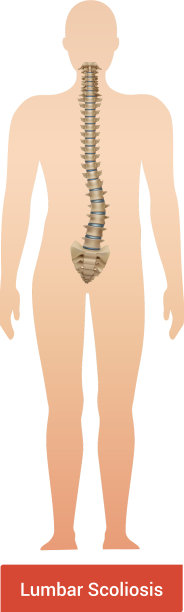 腰椎侧弯解剖组成图片下载