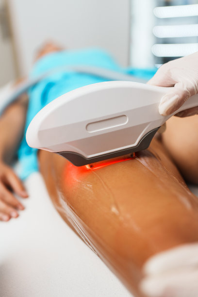 激光脱毛治疗图片下载