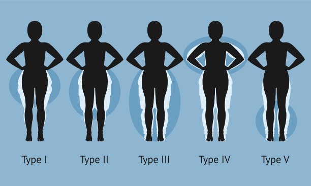 女性体内有不同类型的脂肪水肿图片下载