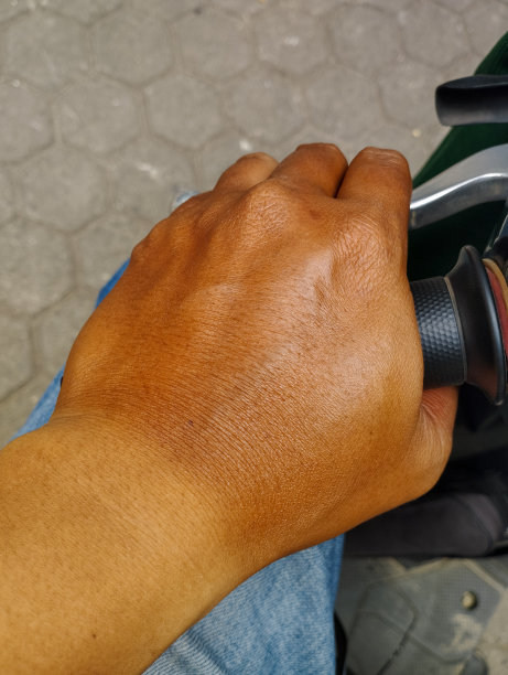 手腕有不同的颜色图片下载