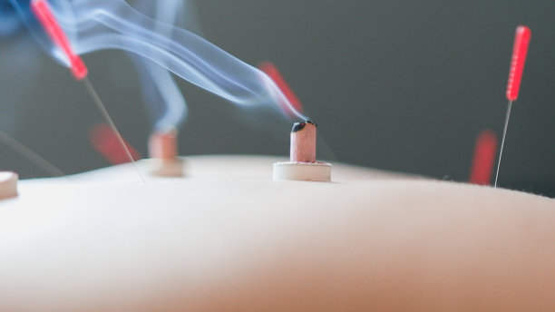 针灸对人体的影响图片下载