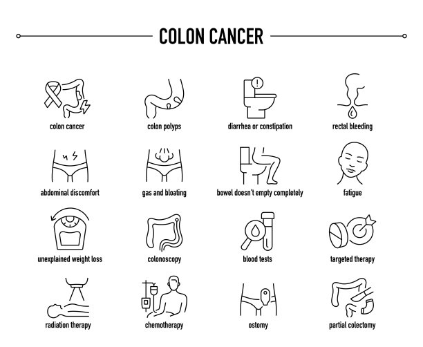 结肠癌矢量图标集。行编辑医疗图标。图片下载